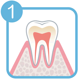 正常の歯